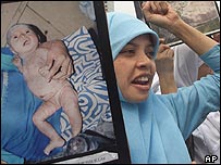 Endonezyalı bir kadın deri hastalığı yaşayan bebeğinin fotoğrafını gösteriyor