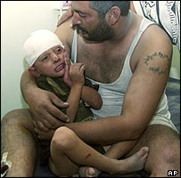 ایک شخص اپنے زخمی بچے کو چپ کرا رہا ہے