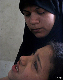 یک زخمی حمله انتحاری کربلا