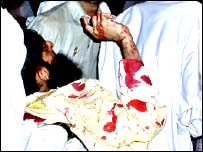 نشتر پارک دھماکہ