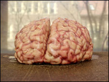 A human brain