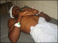 Youth injured in Eravur