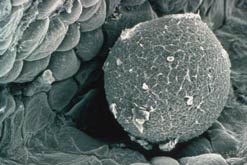 Egg in fallopian tube