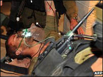 Một lính Israel bị thương