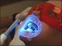 پوسيدگی دندان