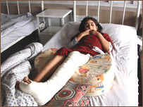 کسراستخوان پا