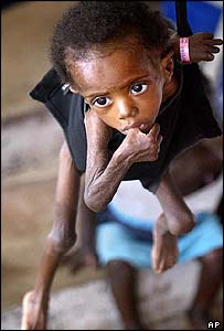 A desnutrição de crianças piorou com o conflito