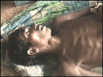 हैज़े का मरीज (फ़ोटो:कलिंग टाइम्स) 