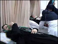 زغال گرفتگی