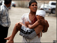 Bağdat'da yaralı bir çocuk