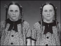 Cayla and Mylee Simmermon, 10 years old, Mylee older by 2 minutes, 2001 (Twins) (detail)