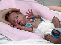 تاخيردرزايمان 