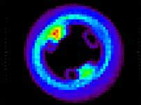 ویگا کے گرد ذرات 