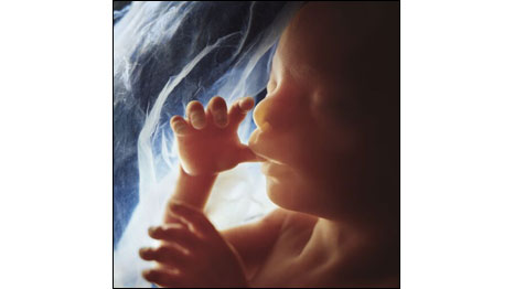 20 semanas (Fotos: Lennart Nilsson)