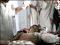 Garoto afegão que teria se ferido em ataque