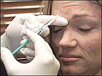 Aplikace injekce botoxu