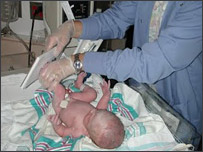  په زېږون کې ځنډ