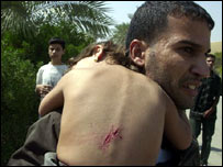 Bağdat'taki saldırıda yaralanan bir çocuk