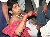 बम धमाके से घायल व्यक्ति