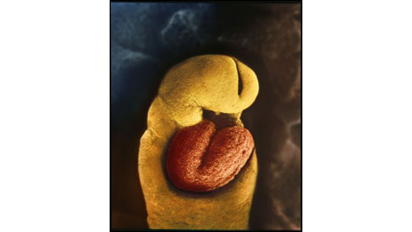 24 dias (Fotos: Lennart Nilsson)