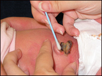 د ماشوم نوم پرې کول