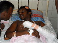 Wounded worker - Photo Prasad Purnimal