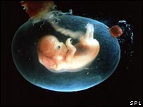 The cells came from the fluid surrounding the developing foetus
