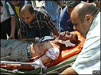 Ferido por explosão de carro-bomba