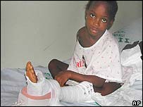 Violência do conflito não poupa nem as crianças