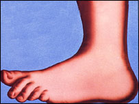 Could this be Wayne Bridges' left foot?!