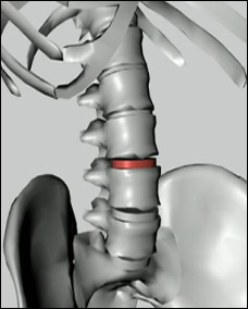 Computer simulation of spine showing disc