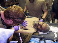 زخمی انفجار ارزگان