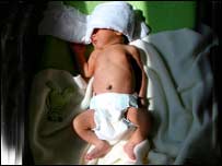 نوی زېږېدلی ماشوم چې ژېړى لري لمر ته پرېاتسل شوی