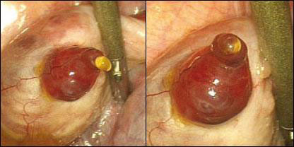 Jacques Donnez. Reprodução: New Scientist