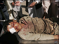 یک مجروح حادثه شیندند هرات