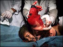 مجروح فلسطینی در بیمارستان غزه