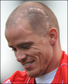 Iain Hume
