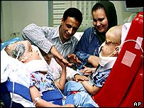 Gêmeos siameses depois da separação