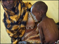 कुपोषण का शिकार बच्चा