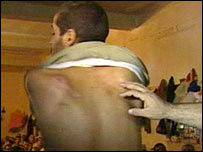 BBC'ye işkence izlerini gösteren biri