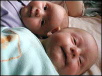 जुड़वाँ बच्चे