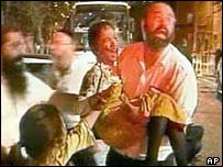 Criança ferida na explosão de um ônibus em Jerusalém