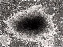 انسانی جلد کے خلیے