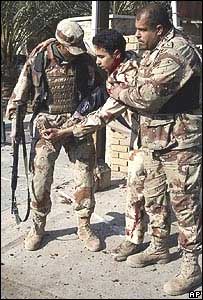 Soldado iraquiano ferido na explosão