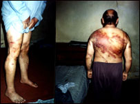 Sunitas que teriam sido torturados pela polícia em Bagdá