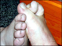toe wrestling