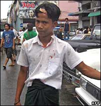 Wounded student in Burma
