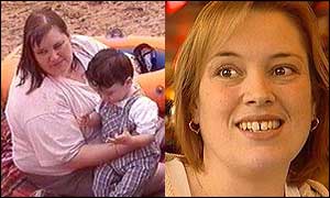 Teena Hill before and after her surgery