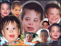 عقب مانی ذهنی