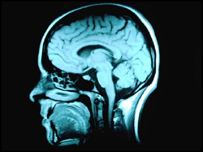 انسانی دماغ